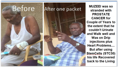 He suffered from cancer for 7 good years but see the wonders of stc30.👆👆👆🤭🤭🤭👆👆👆