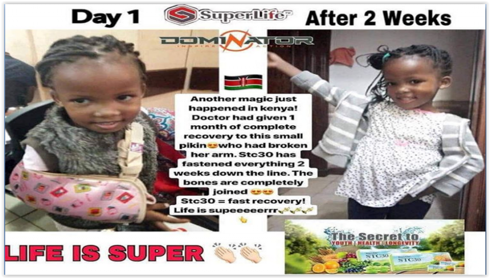 The baby's arm was broken but Stc30 did it's work and in 2 weeks, she felt better.🤭🤭🤭 👆👆👆