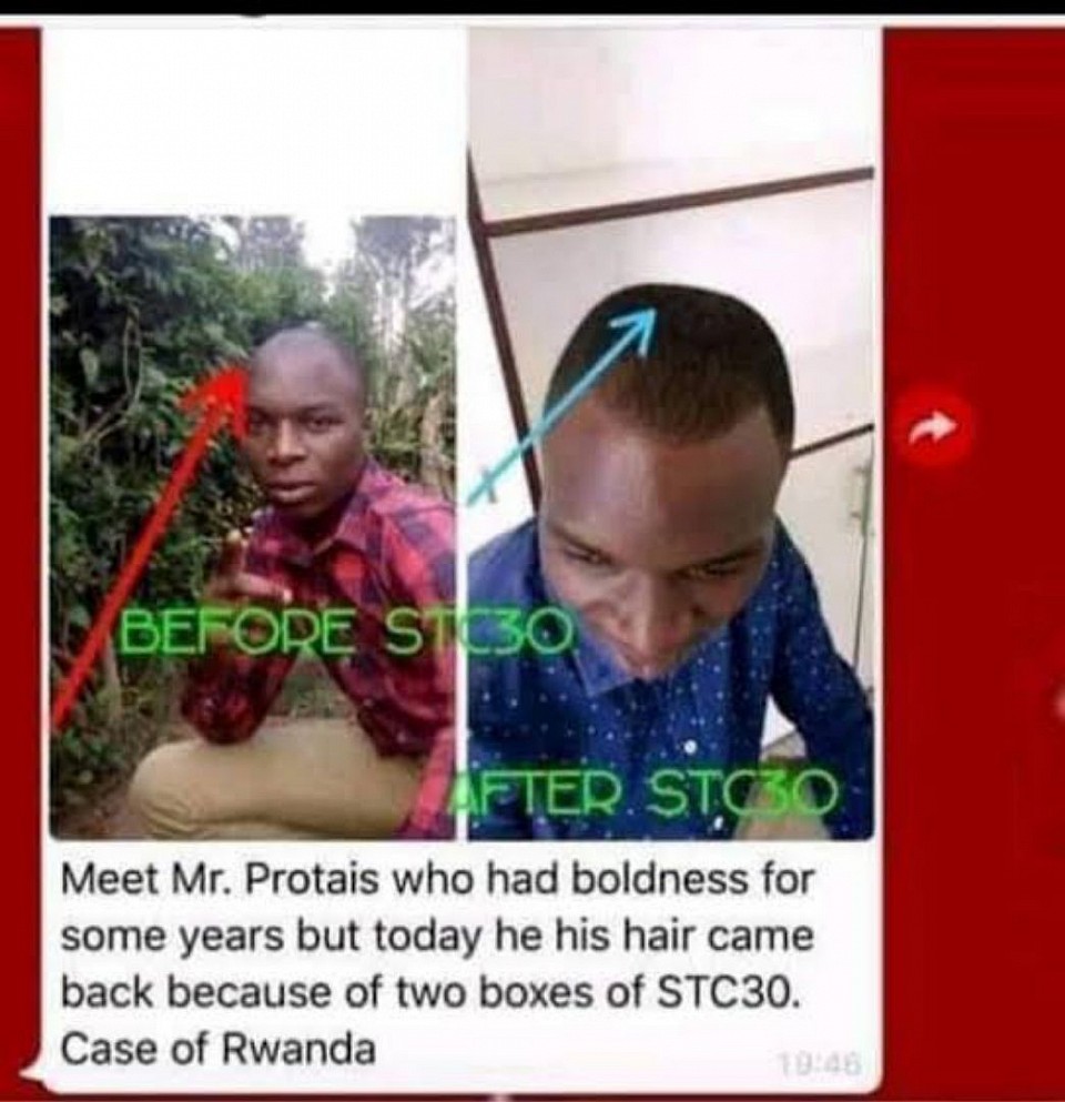 A man from Rwanda used 30 sachets of Stc30. In a space of 1 month, look at what happened 👆👆🤭🤭👆👆👆🤭