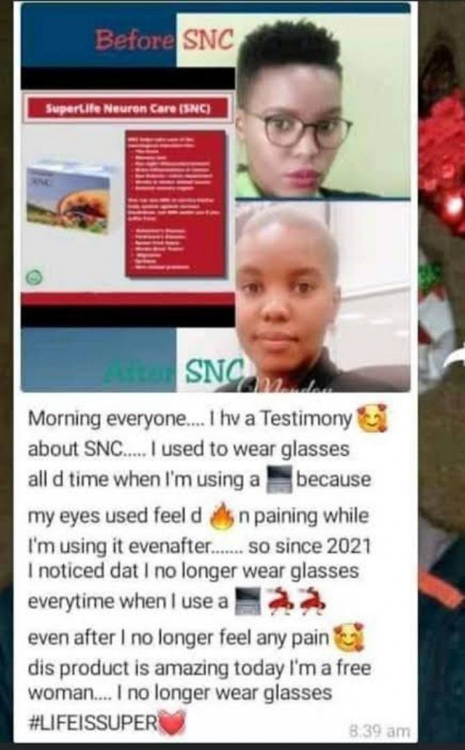 Her eyes got well because of using SNC. She is no longer wearing glasses.🤭👆👆👆👆👍👍🤗😀