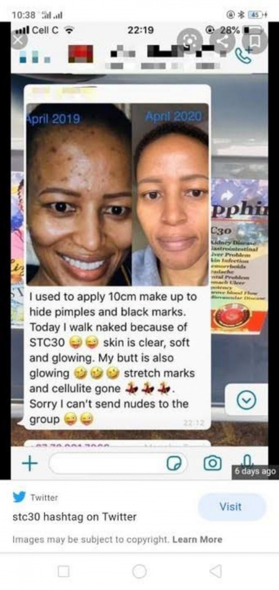 Stc30 testimony on pimples🤗🤗👍👆👆👆👆🤭