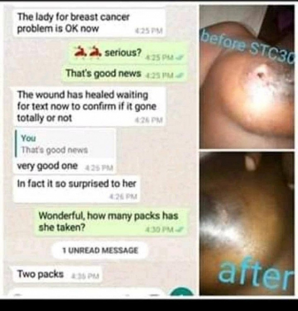 She used 30 sachets of stc30 when she had breast cancer. Look at what happened to her after 30 days👆👆👆👆🤗👏👏