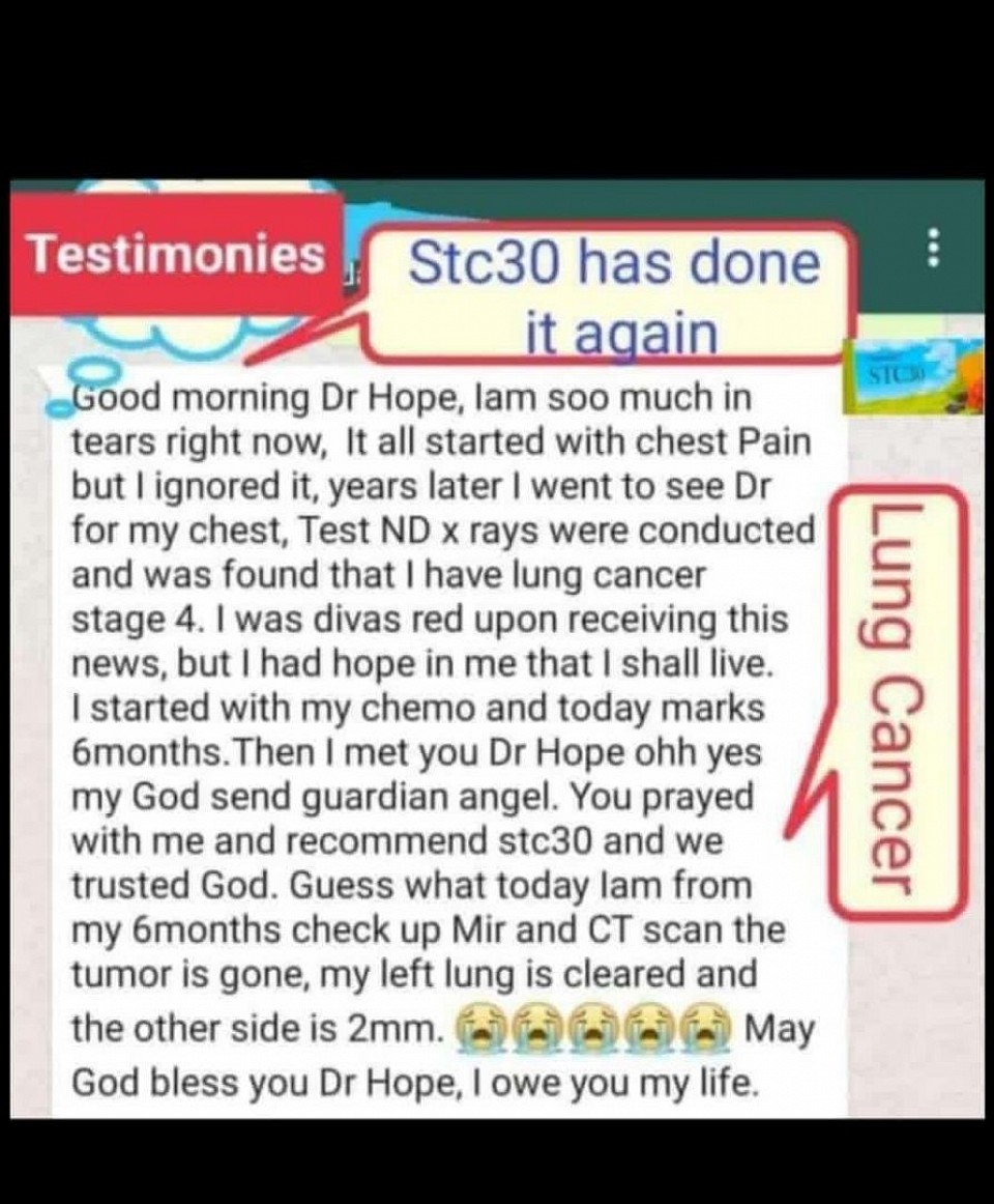 In 6 months, lung cancer had gone because of stc30🤗🤗👏👏👏👏👆👆👆👆👆