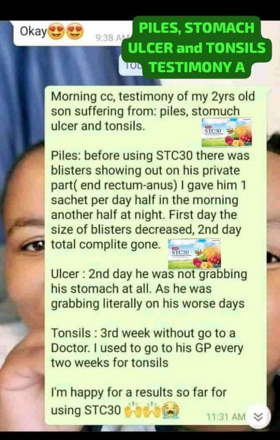 Testimony on stomach ulcers, piles, and tonsils testimony because of stc30 👆👆👆👆👆👆